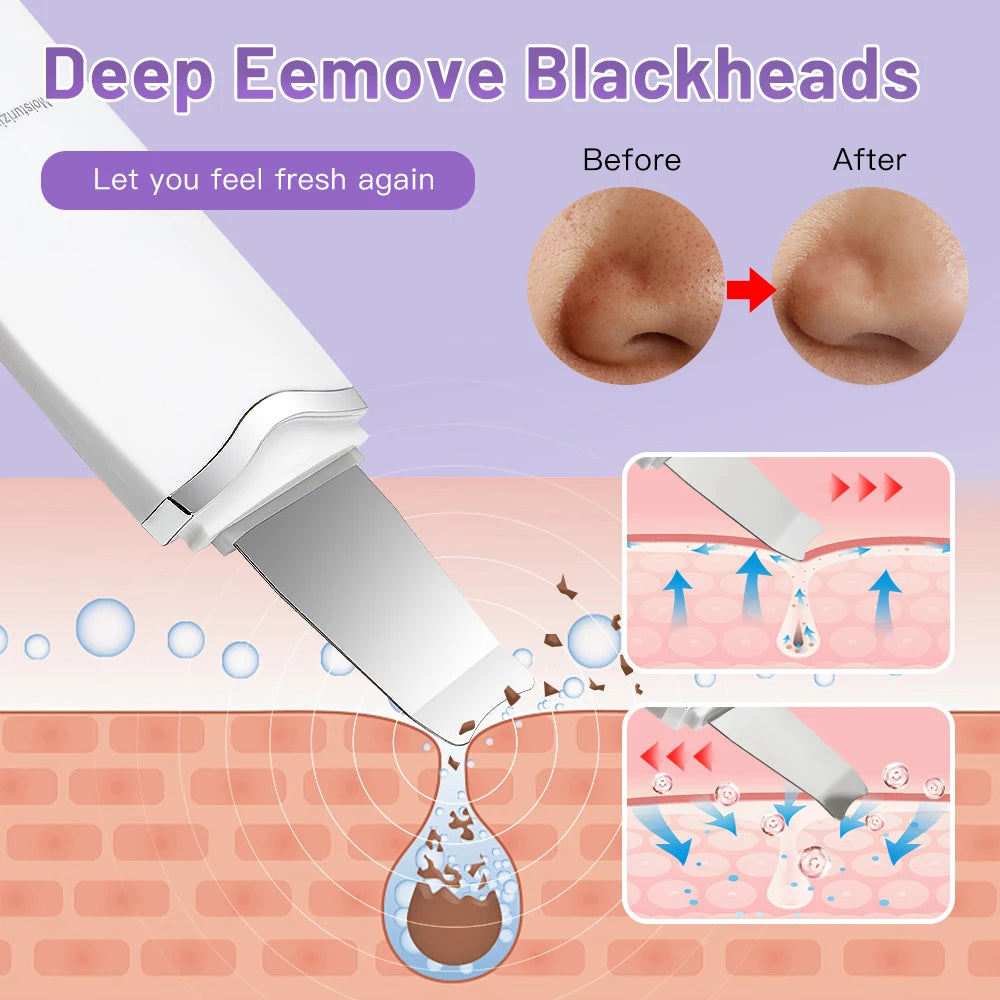 Electric Ultrasonic Skin Scrubber - Elfinna