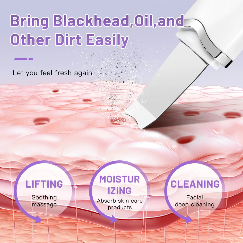 Electric Ultrasonic Skin Scrubber - Elfinna
