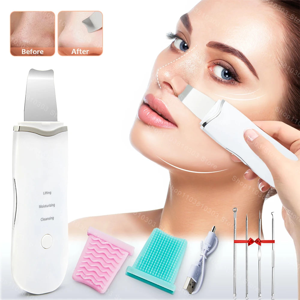 Electric Ultrasonic Skin Scrubber - Elfinna
