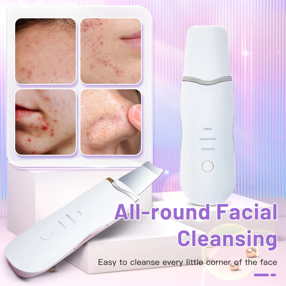 Electric Ultrasonic Skin Scrubber - Elfinna